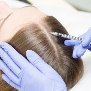 Mesotherapy for Hair at Portofino Clinic