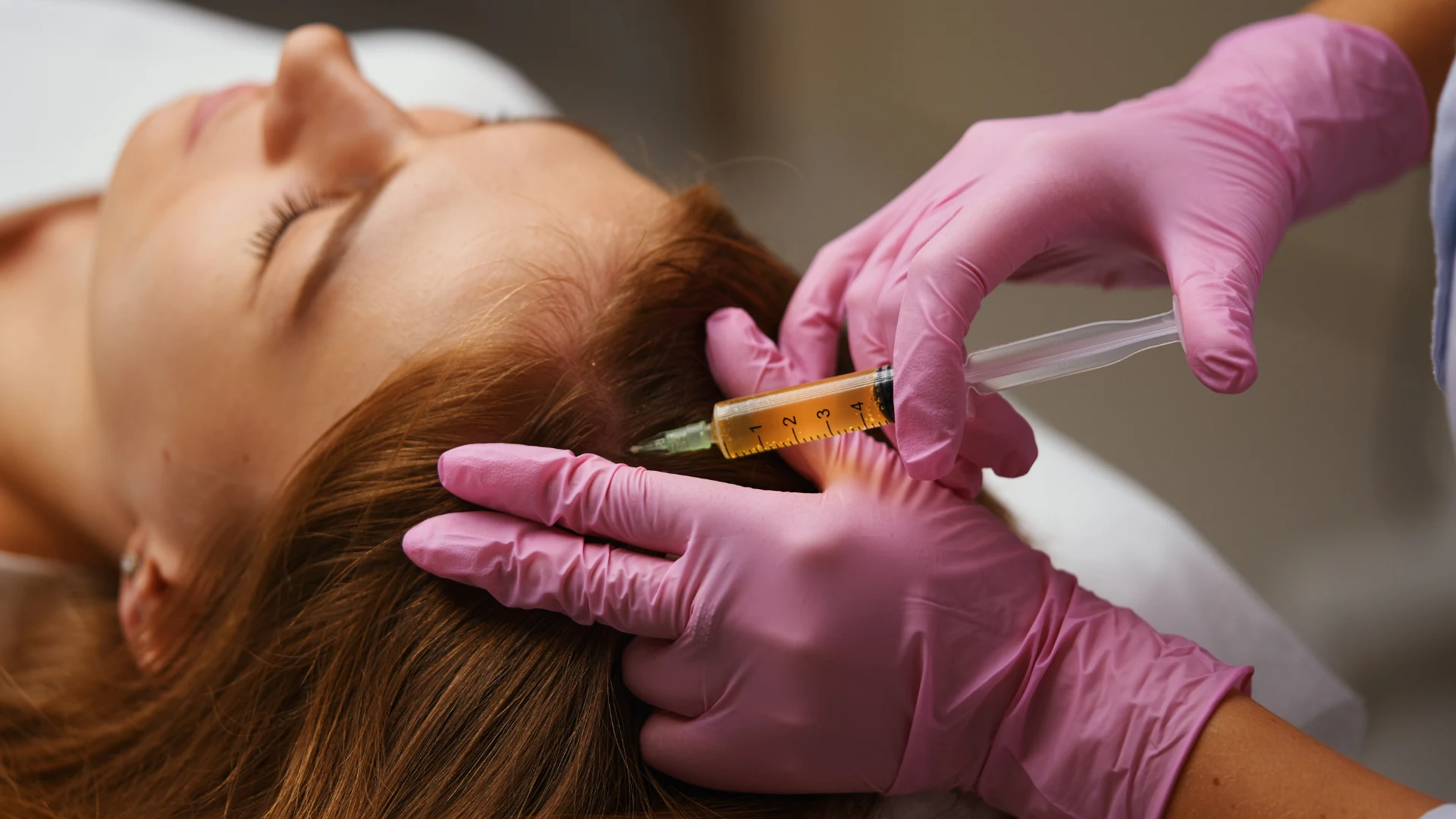 PRP Injection Treatment at Portofino Aesthetic Clinic