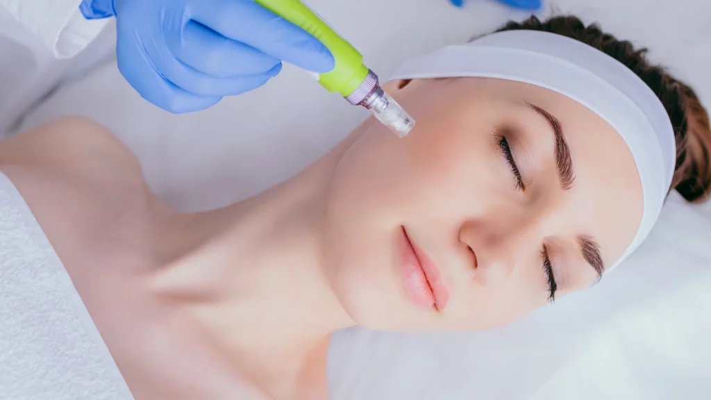 Collagen Induction Therapy- Portofino Aesthetic Clinic