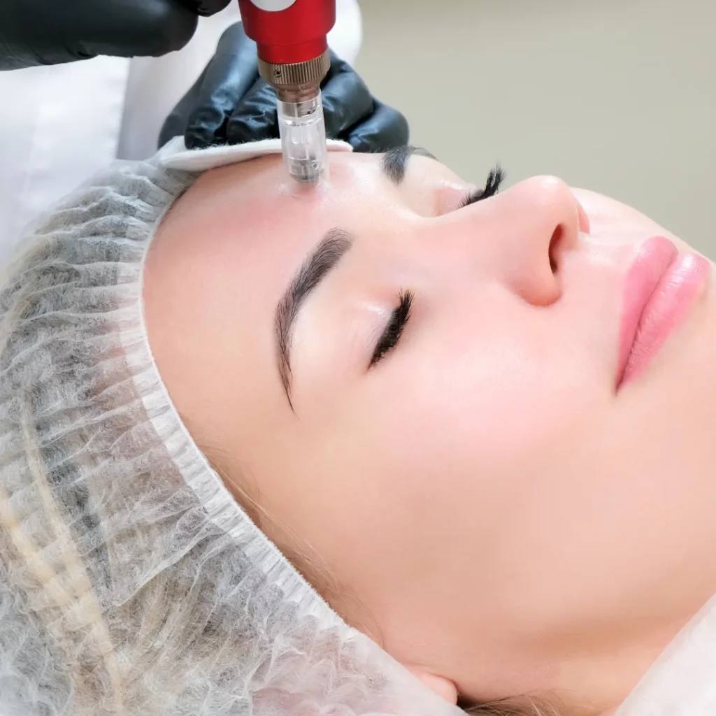 How does Collagen Induction Therapy[CIT] work?