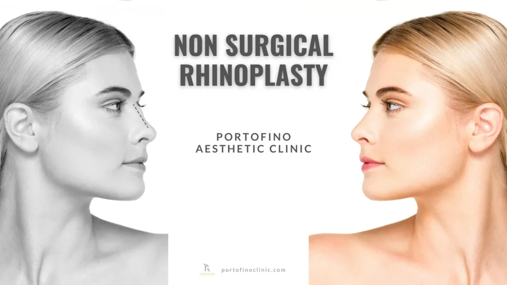 Non Surgical Rhinoplasty