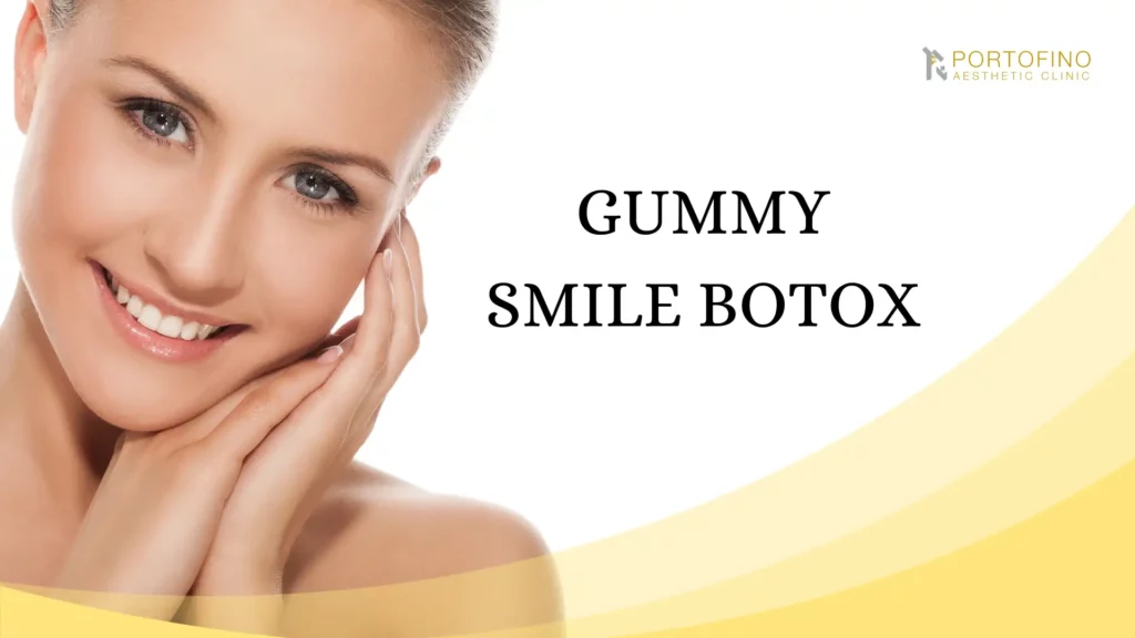Gummy Smile Botox