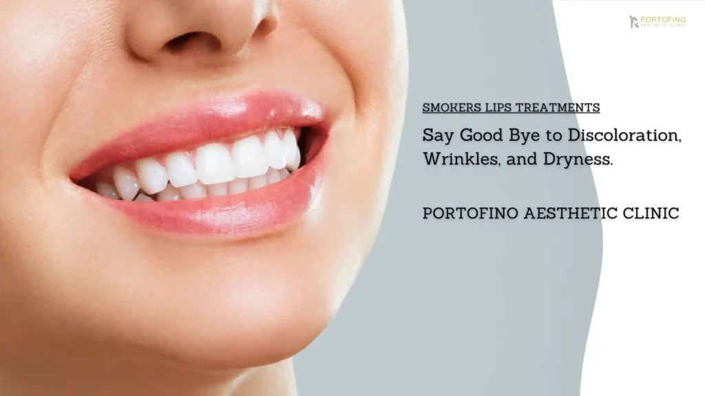 Smokers Lips Treatment at Portofino Clinic