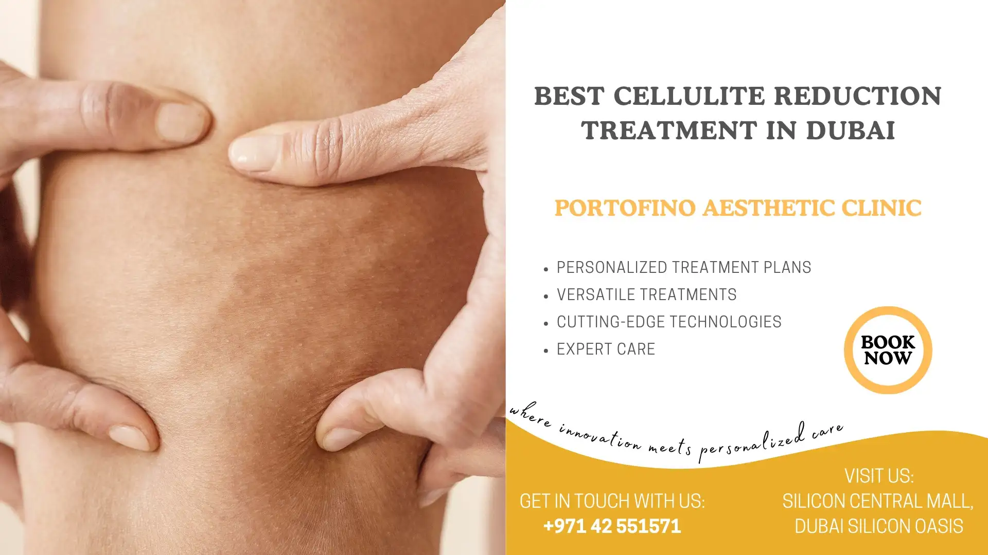 Best Cellulite Reduction Treatment in Dubai