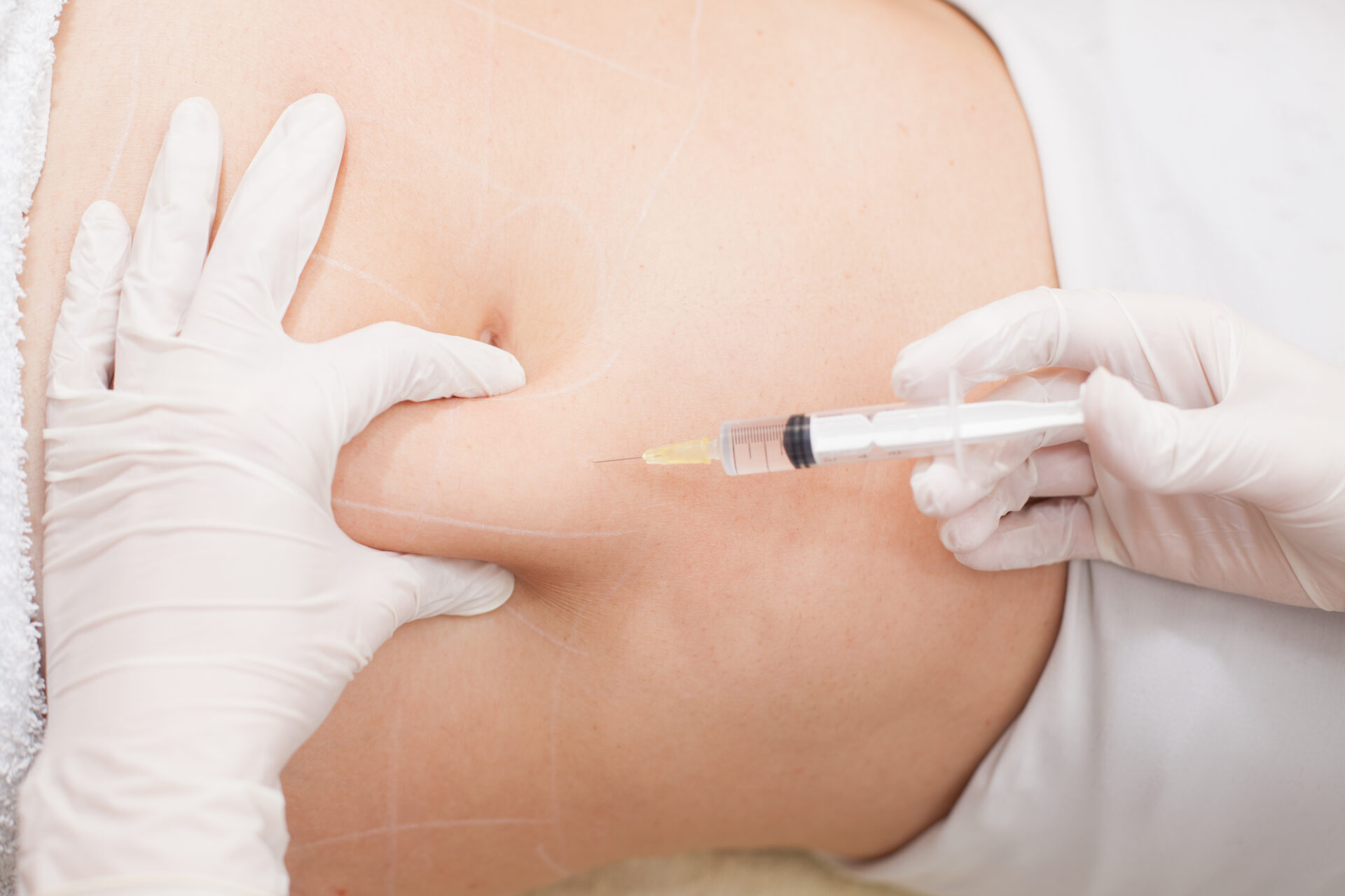 Fat Dissolving Injections In Dubai | Portofino Clinic