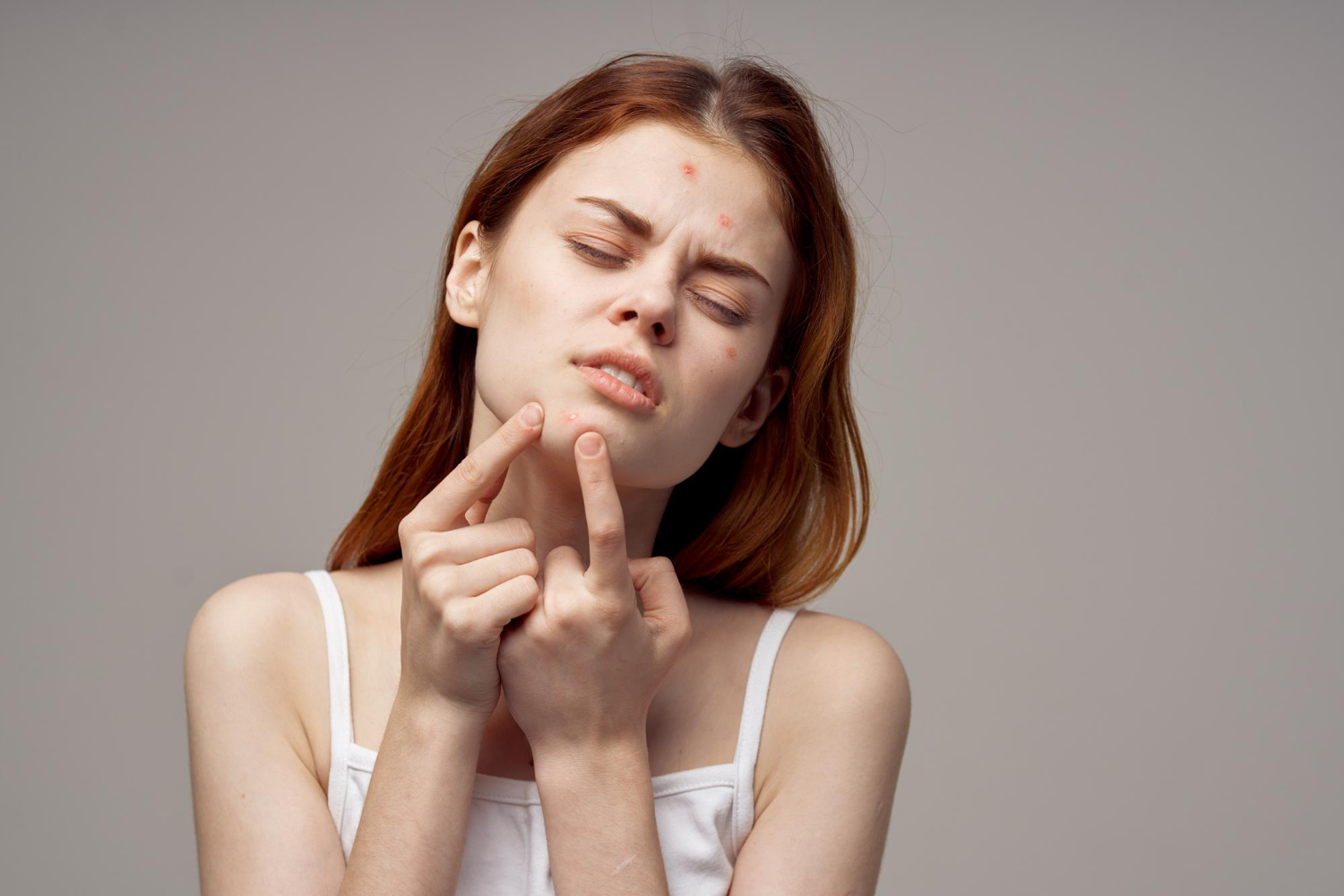 Best Acne Scar Removal Treatments In Dubai
