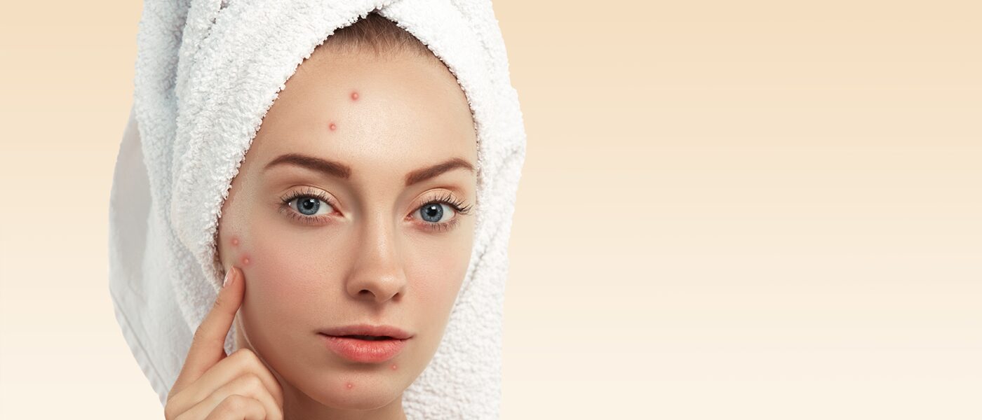 salicylic acid for warts salicylic-acid-for-warts
