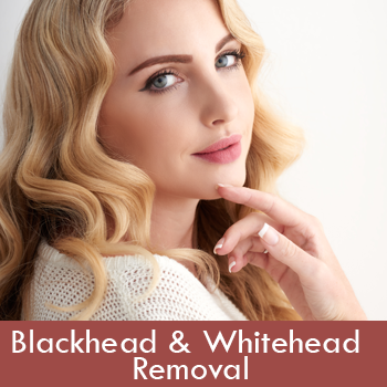 Blackhead-&-Whitehead-Removal