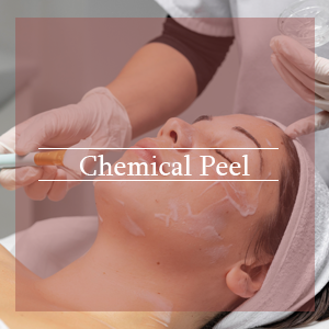 chemical-peel