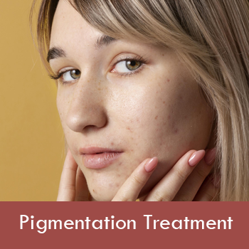 pigmentation-treatment