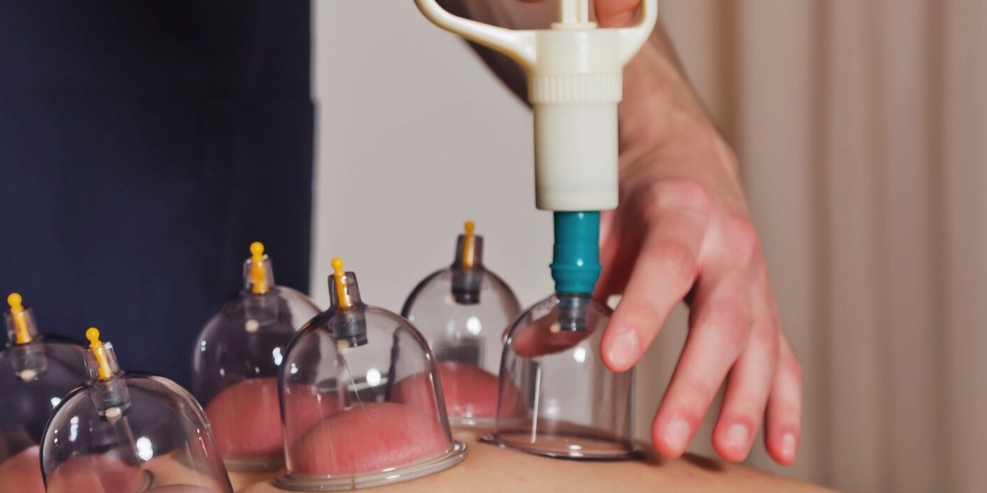 Best Hijama Cupping in Dubai