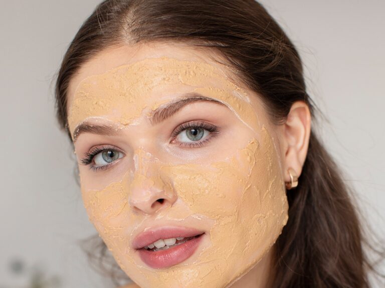chemical peel