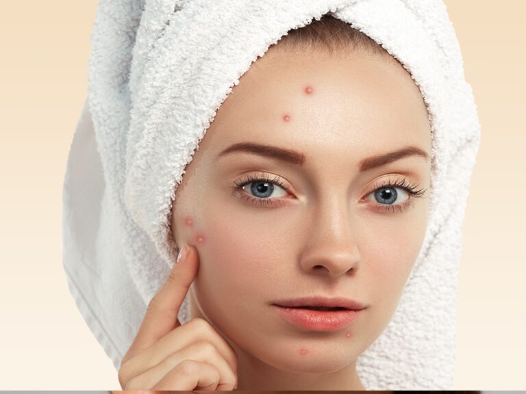 laser-skin-tag-removal