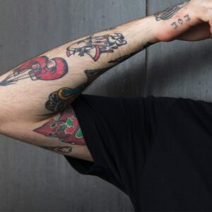 tattoo removal dubai