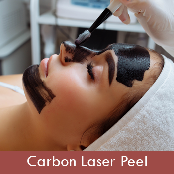 Carbon laser peel dubai